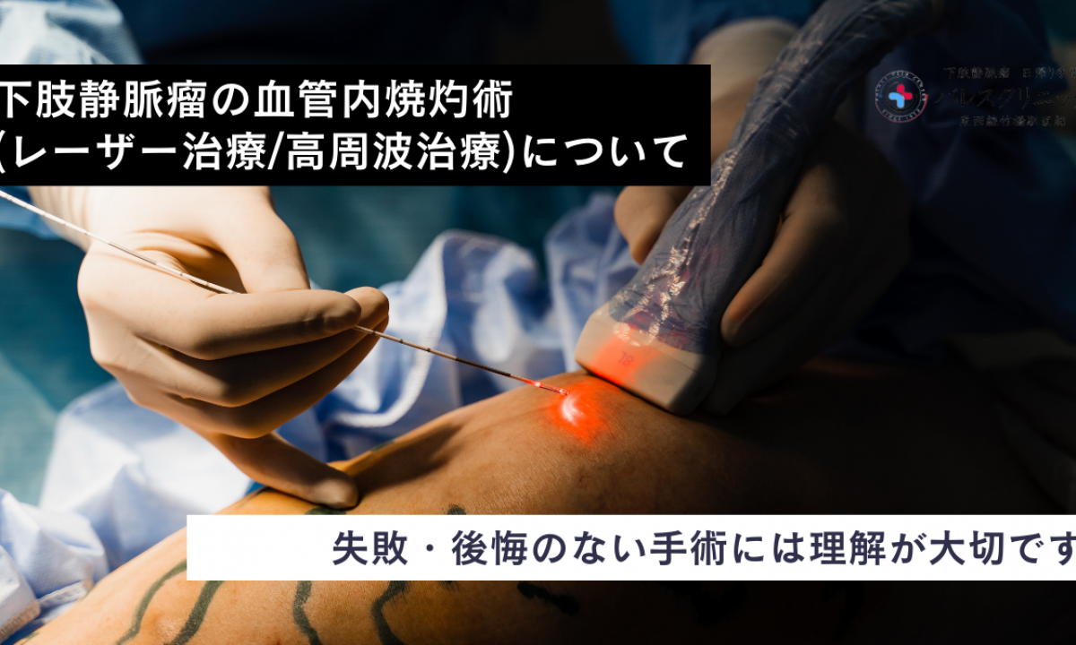「下肢静脈瘤血管内焼灼術 レーザーおよび高周波焼灼術」 下肢静脈瘤の血管内焼灼術(レーザー治療/高周波治療)について