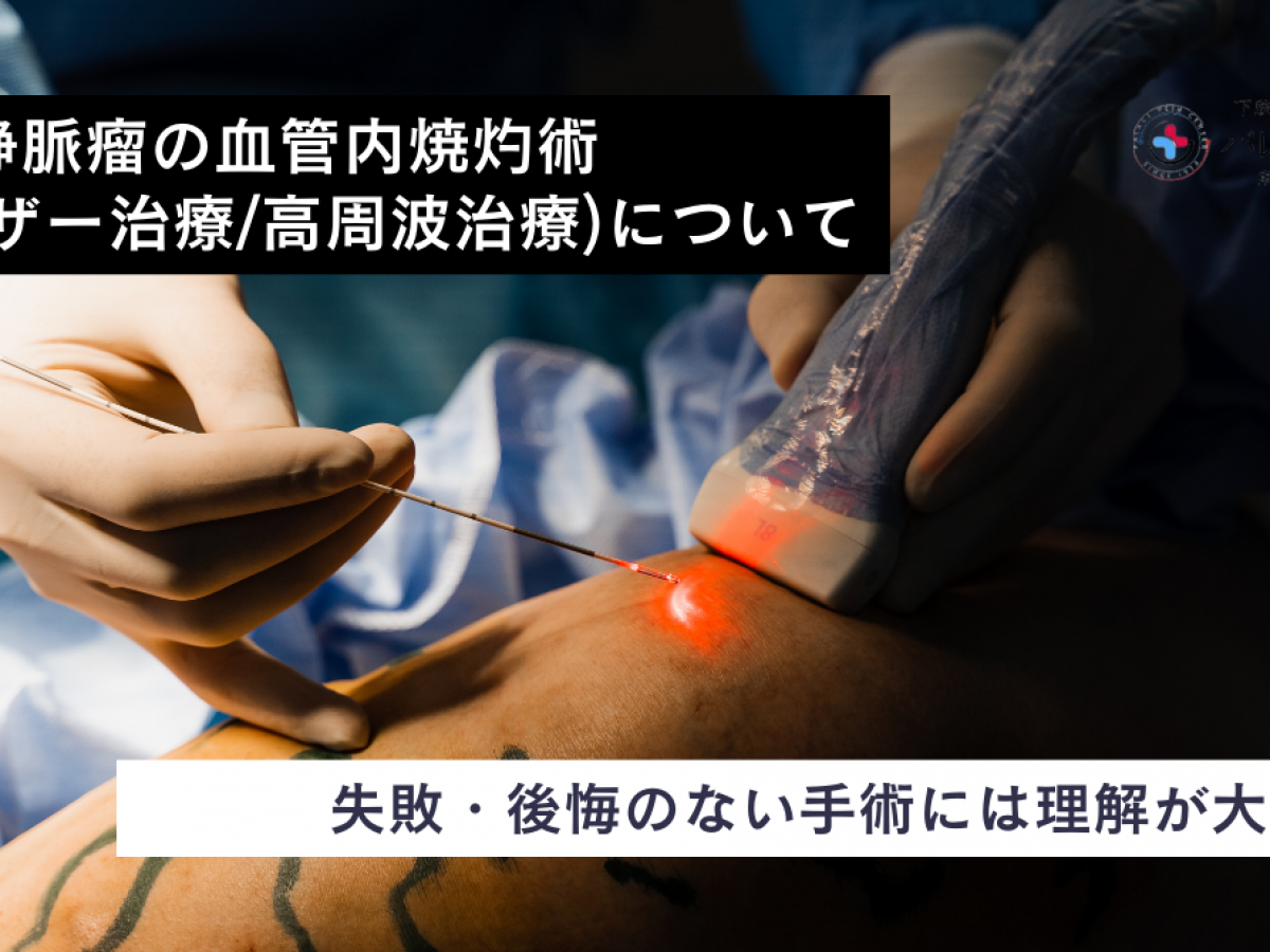 「下肢静脈瘤血管内焼灼術 レーザーおよび高周波焼灼術」 下肢静脈瘤の血管内焼灼術（レーザー・高周波治療）｜東京都台東