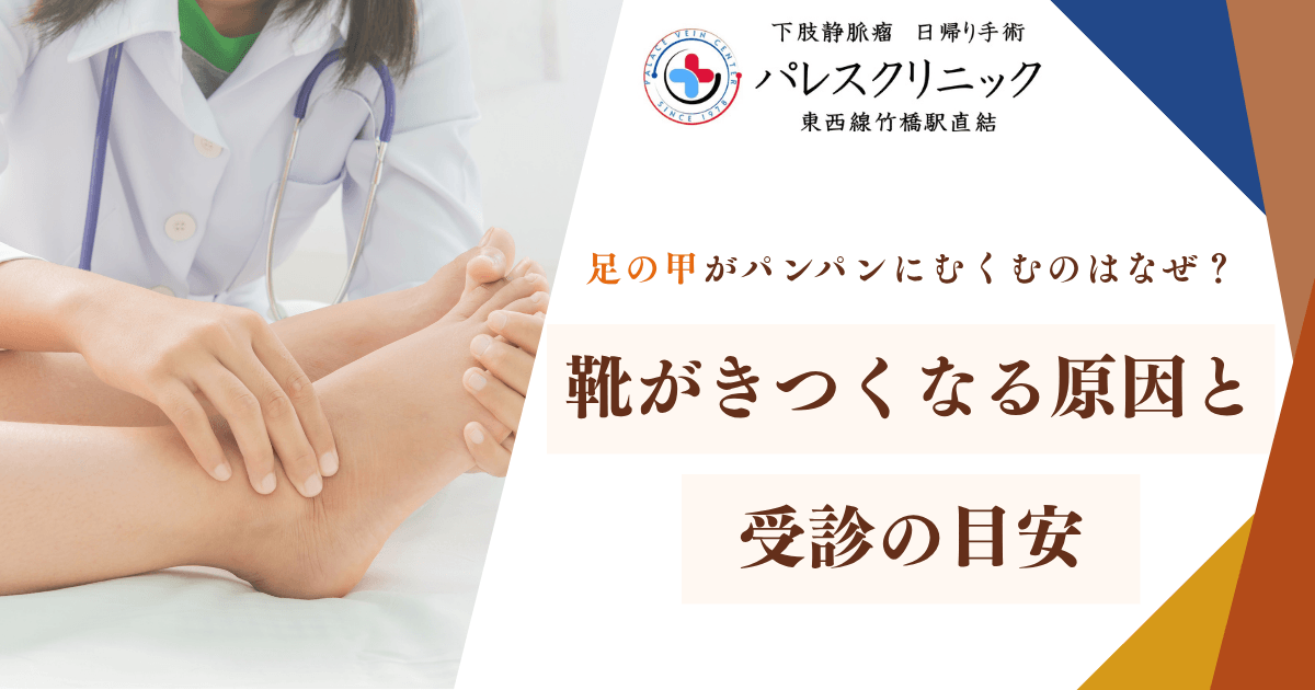 足の甲がパンパンにむくむのはなぜ？靴がきつくなる原因と受診の目安