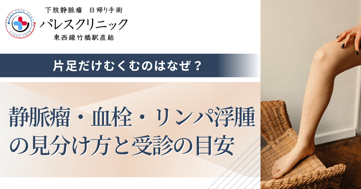 片足だけむくむのはなぜ？静脈瘤・血栓・リンパ浮腫の見分け方と受診の目安