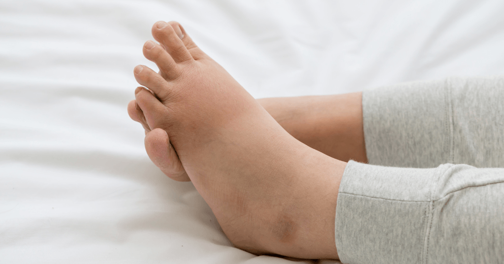 自分でできる対策と注意点
