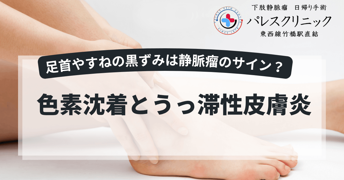 足首やすねの黒ずみは静脈瘤のサイン？色素沈着とうっ滞性皮膚炎