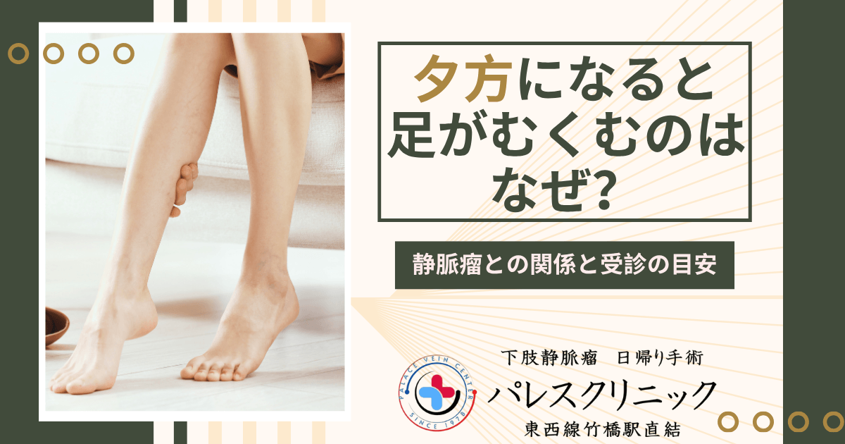 夕方になると足がむくむのはなぜ？静脈瘤との関係と受診の目安