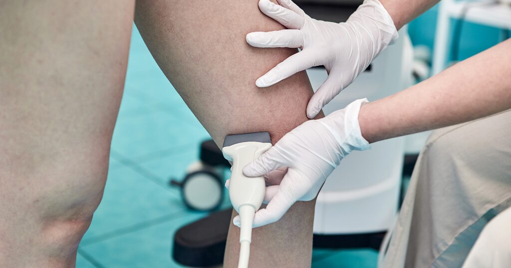 運動してよいか迷う場合に静脈エコー検査で確認できること