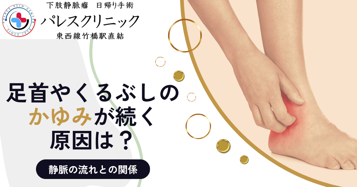 足首やくるぶしのかゆみが続く原因は？静脈の流れとの関係