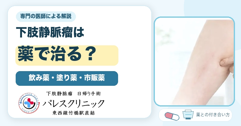 下肢静脈瘤は薬で治る？飲み薬・塗り薬・市販薬を専門の医師が解説するアイキャッチ