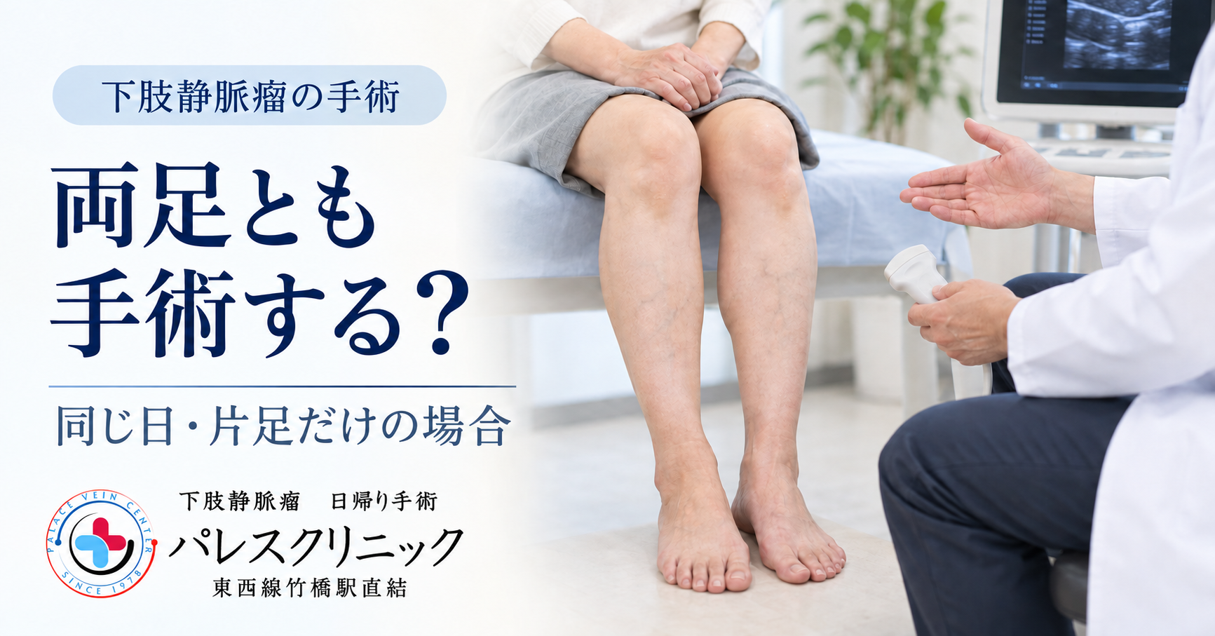 下肢静脈瘤の両足手術について、左右の治療を相談するイメージ