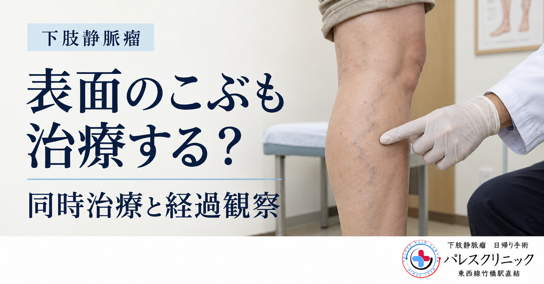 下肢静脈瘤の表面のこぶについて、同時に治療する場合と経過をみる場合を伝える画像