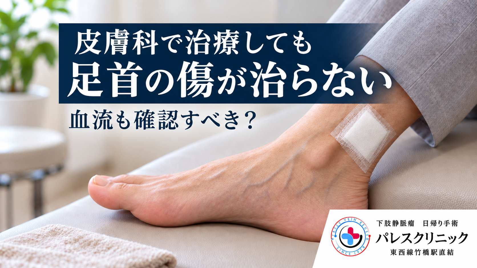 足の内くるぶし付近に白いガーゼを当てた説明用イメージ。