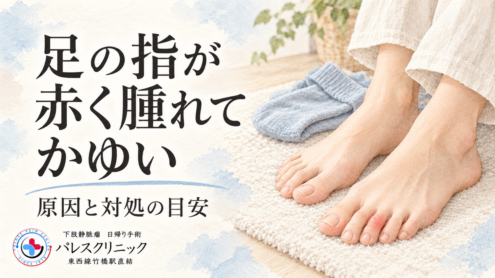 足の指の赤み・腫れ・かゆみの原因と対処の目安を示す、足元と靴下のイメージ。