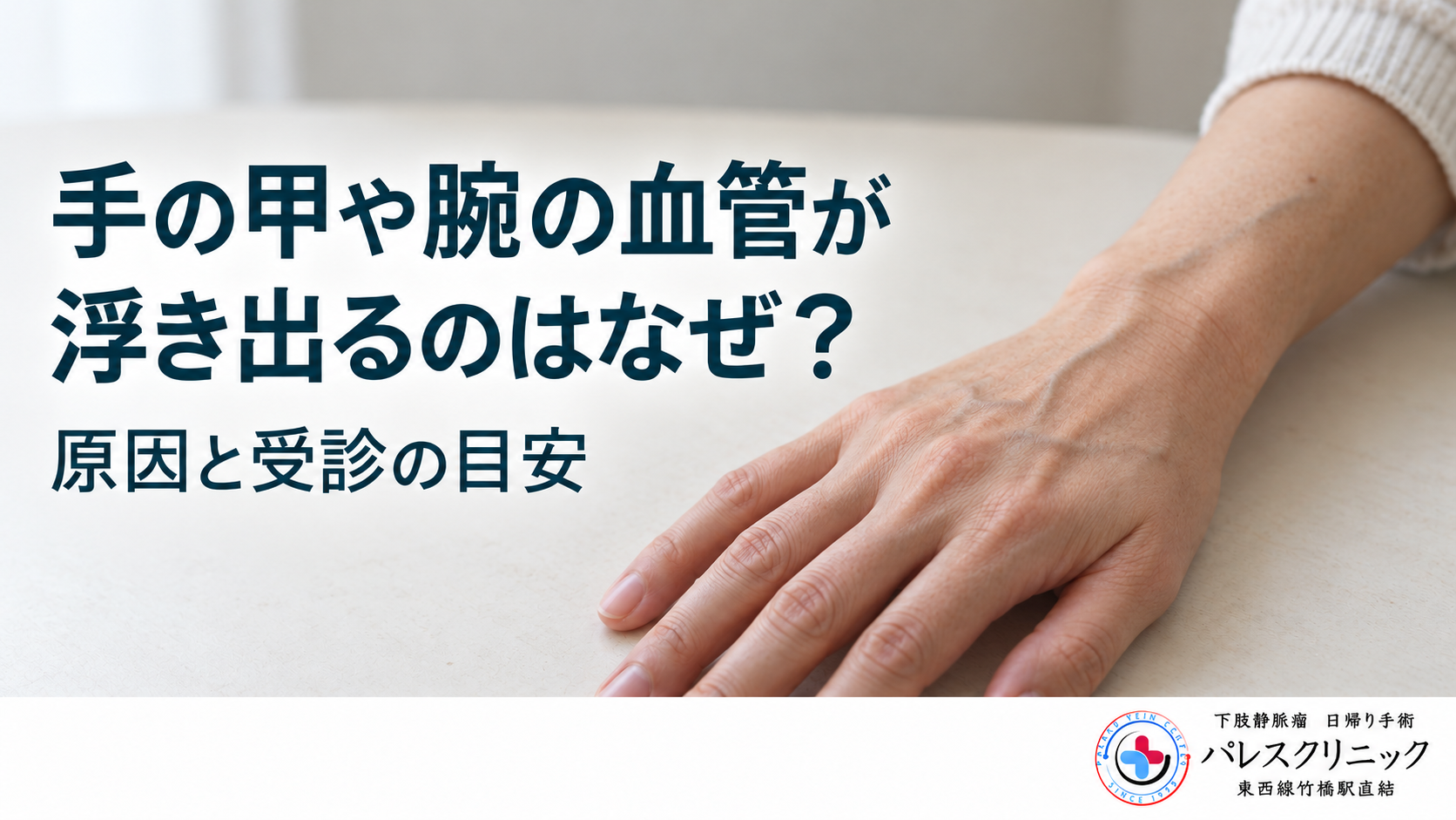 手の甲や腕の血管が浮き出る原因と受診の目安を解説する記事のアイキャッチ
